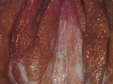 Medium